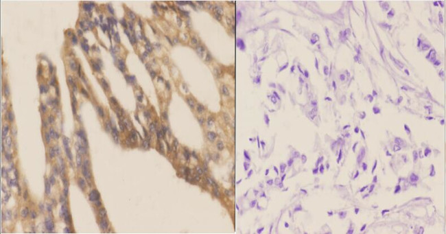 DAP5 Antibody in Immunohistochemistry (Paraffin) (IHC (P))