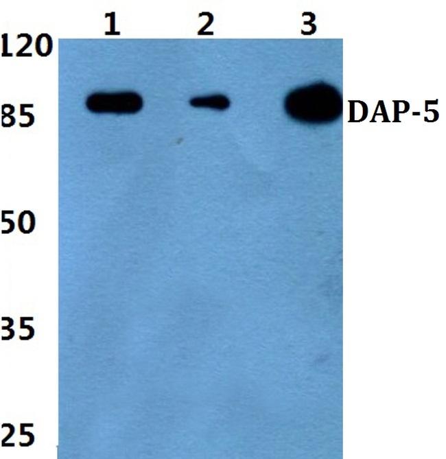DAP5 Antibody in Western Blot (WB)