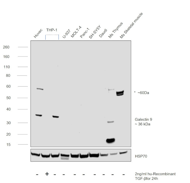 Galectin 9 Antibody