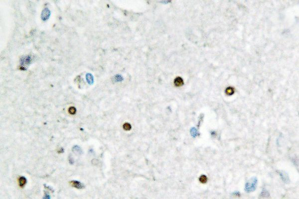 MSH6 Antibody in Immunohistochemistry (Paraffin) (IHC (P))