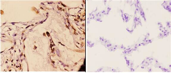 14-3-3 gamma Antibody in Immunohistochemistry (Paraffin) (IHC (P))