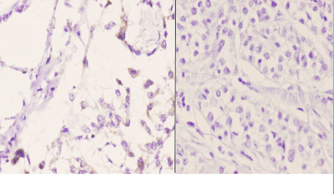 Bcl-W Antibody in Immunohistochemistry (Paraffin) (IHC (P))