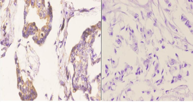 Bcl-W Antibody in Immunohistochemistry (Paraffin) (IHC (P))