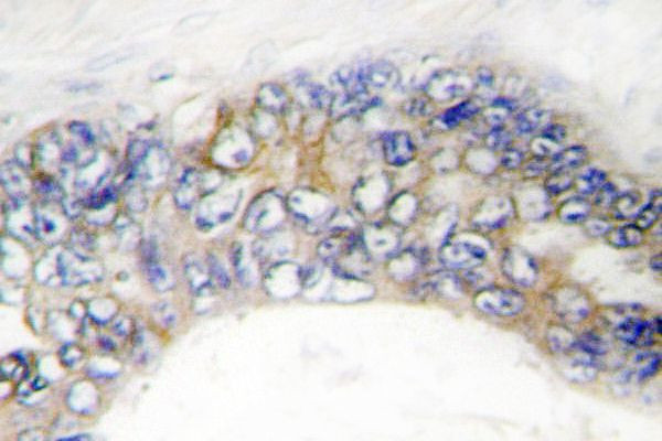 DcR3 Antibody in Immunohistochemistry (Paraffin) (IHC (P))