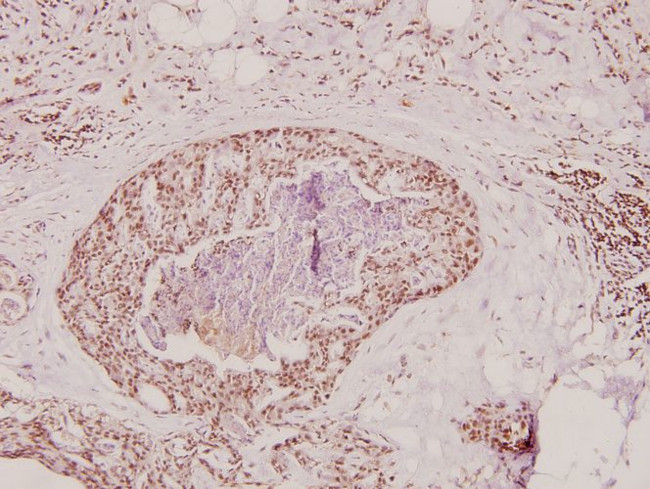 Prothrombin Antibody in Immunohistochemistry (Paraffin) (IHC (P))