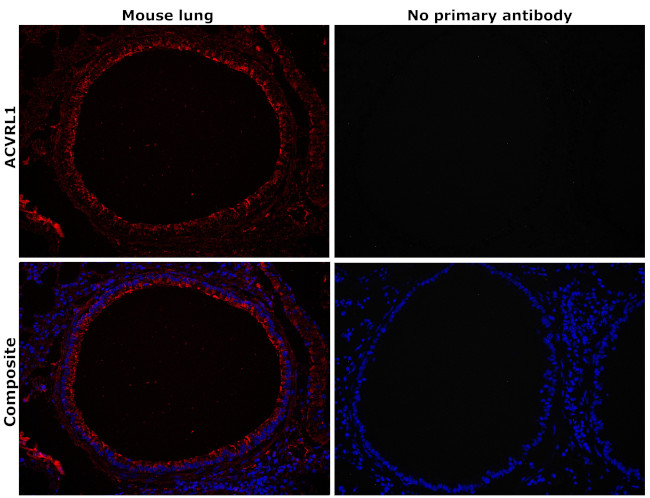 ACVRL1 Antibody in Immunohistochemistry (Paraffin) (IHC (P))