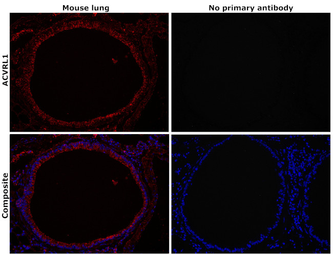 ACVRL1 Antibody in Immunohistochemistry (Paraffin) (IHC (P))