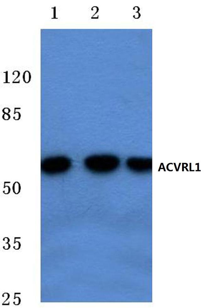 ACVRL1 Antibody in Western Blot (WB)