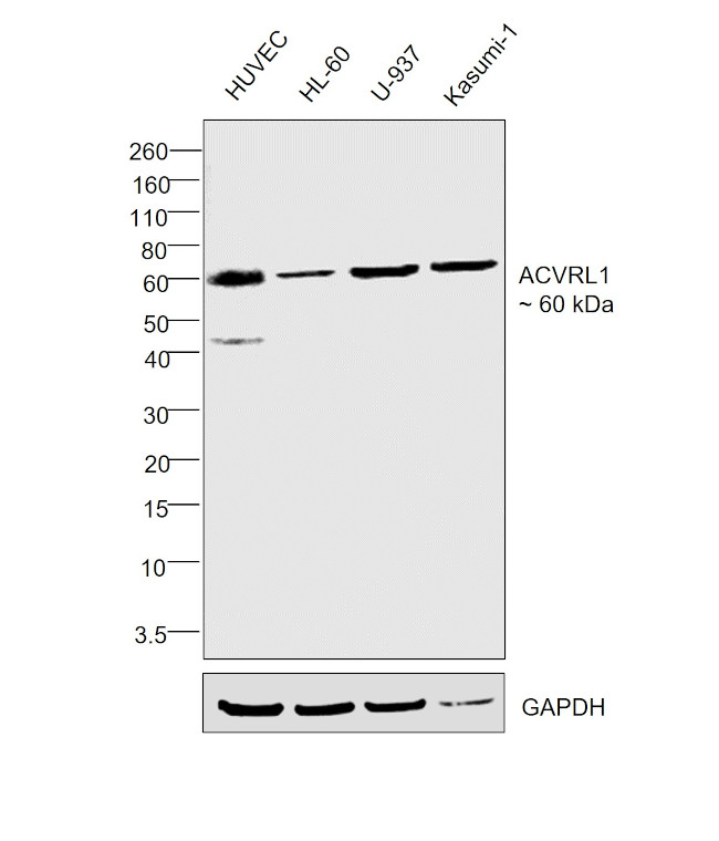 ACVRL1 Antibody in Western Blot (WB)