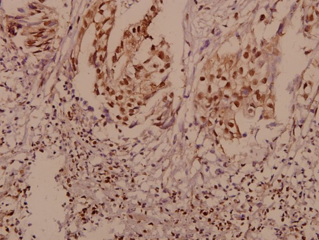 P-cadherin Antibody in Immunohistochemistry (Paraffin) (IHC (P))