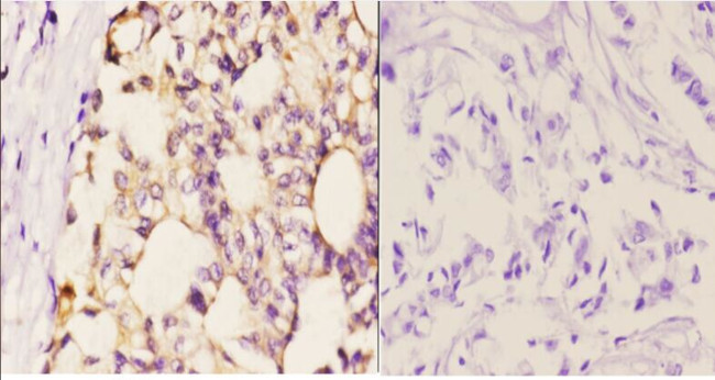 beta-2 Adrenergic Receptor Antibody in Immunohistochemistry (Paraffin) (IHC (P))