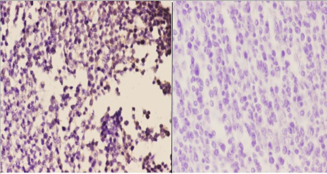 beta-2 Adrenergic Receptor Antibody in Immunohistochemistry (Paraffin) (IHC (P))