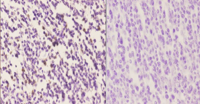 IRF4 Antibody in Immunohistochemistry (Paraffin) (IHC (P))