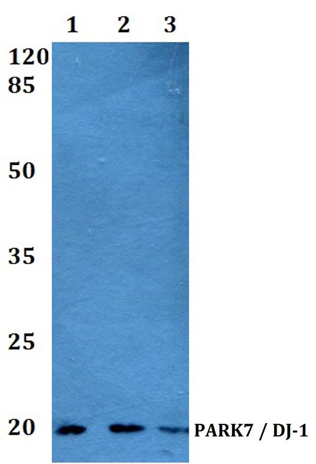 DJ-1 Antibody in Western Blot (WB)