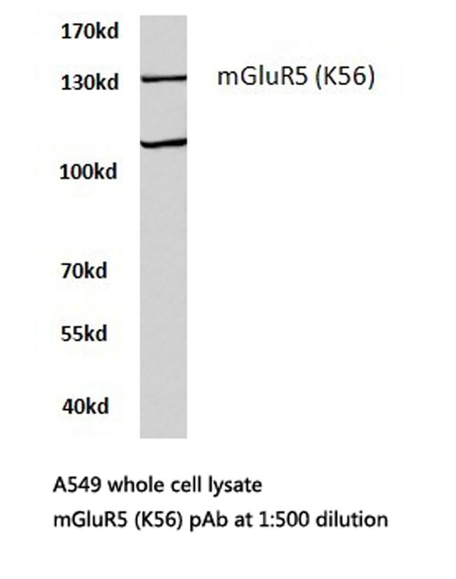 mGluR5 Antibody in Western Blot (WB)