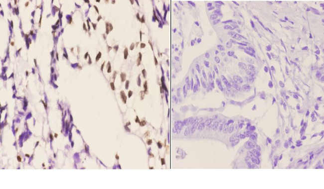 Histone H2A.X Antibody in Immunohistochemistry (Paraffin) (IHC (P))