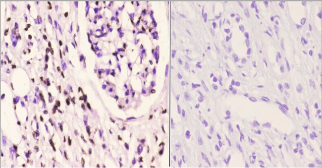 Histone H2A.X Antibody in Immunohistochemistry (Paraffin) (IHC (P))