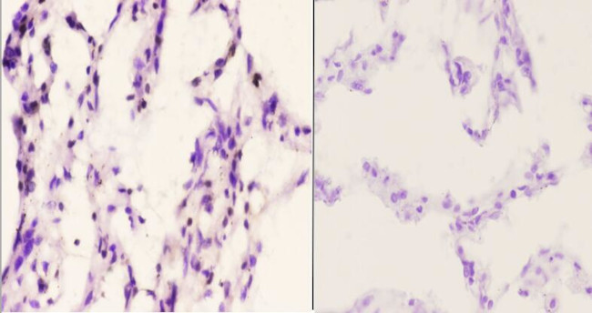 Histone H2A.X Antibody in Immunohistochemistry (Paraffin) (IHC (P))