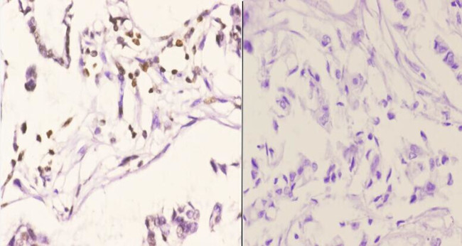 Histone H2A.X Antibody in Immunohistochemistry (Paraffin) (IHC (P))