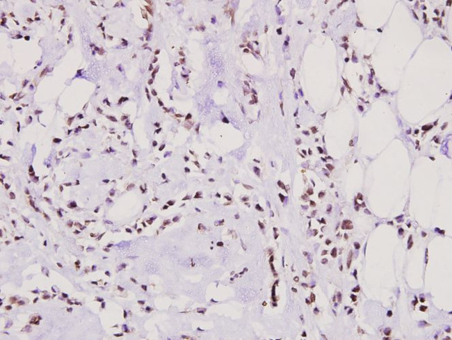 hnRNP M Antibody in Immunohistochemistry (Paraffin) (IHC (P))