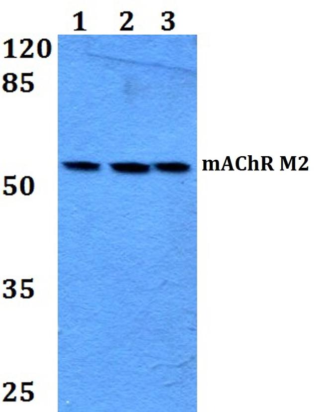 CHRM2 Antibody in Western Blot (WB)