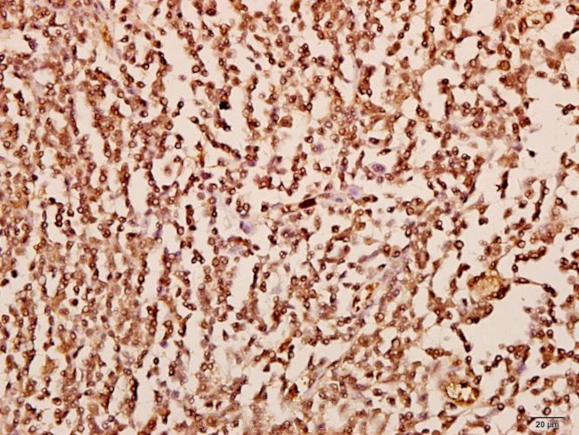 CXCL1 Antibody in Immunohistochemistry (Paraffin) (IHC (P))