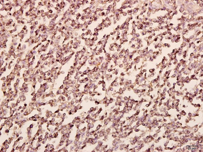 PFKP Antibody in Immunohistochemistry (Paraffin) (IHC (P))