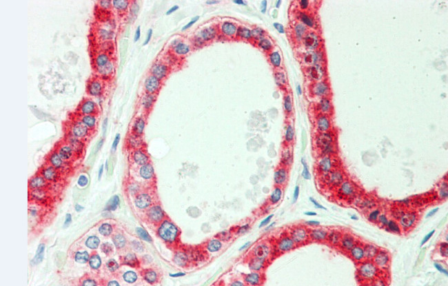 PFKP Antibody in Immunohistochemistry (Paraffin) (IHC (P))