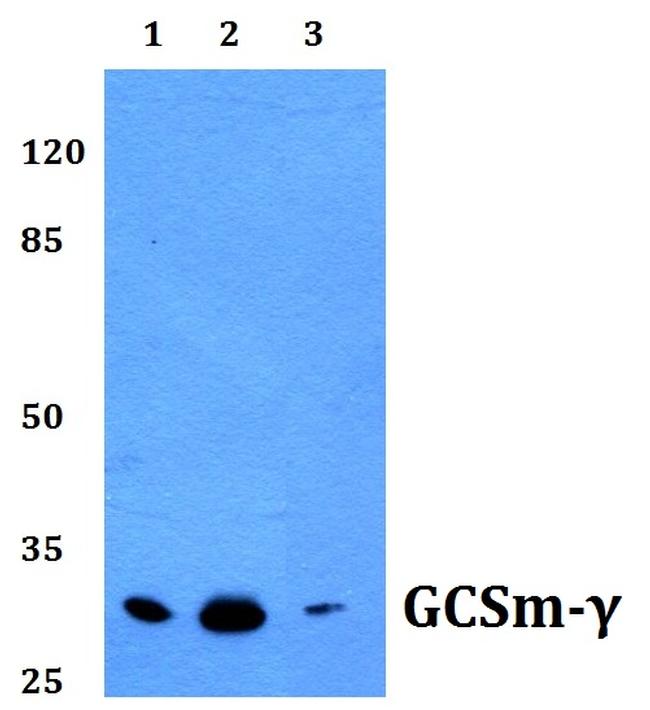 GCLM Antibody in Western Blot (WB)