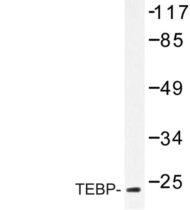 p23 Antibody in Western Blot (WB)