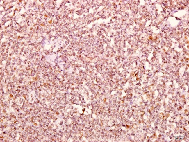 delta Catenin Antibody in Immunohistochemistry (Paraffin) (IHC (P))