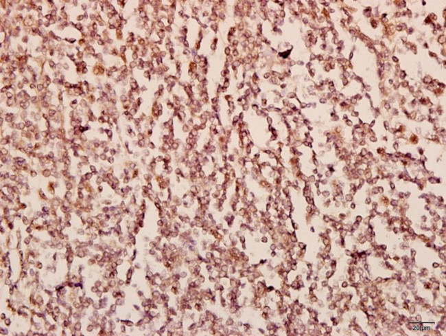 ZEB2 Antibody in Immunohistochemistry (Paraffin) (IHC (P))