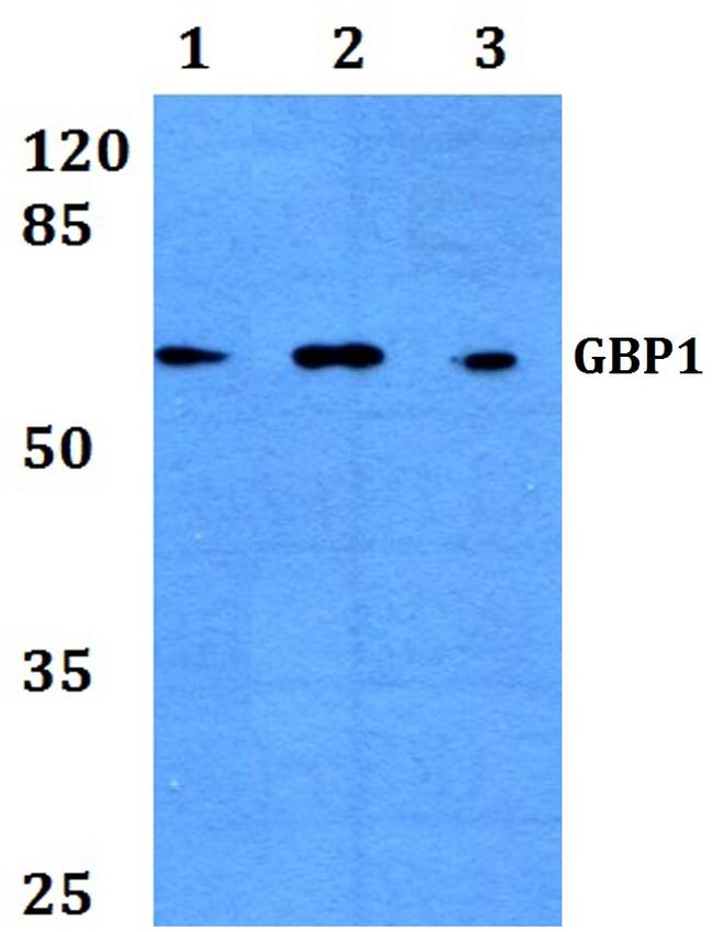 GBP1 Antibody in Western Blot (WB)