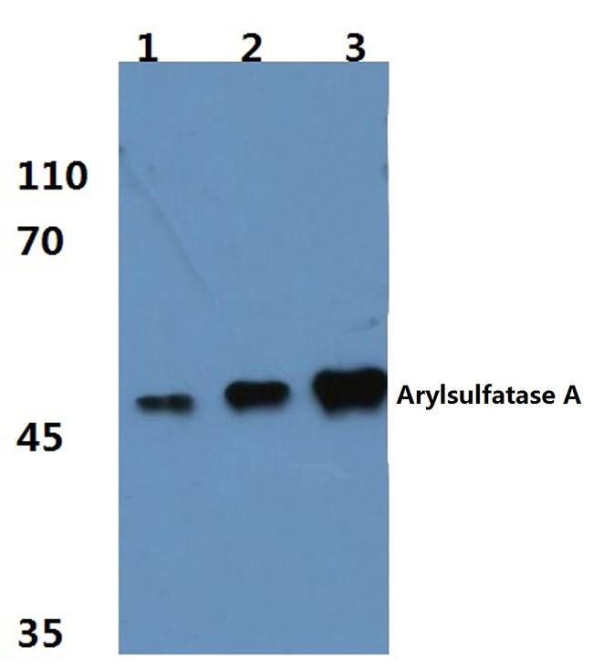 Arylsulfatase A Antibody in Western Blot (WB)