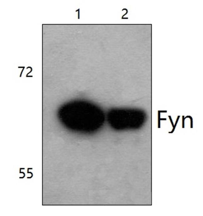 Fyn Antibody in Western Blot (WB)