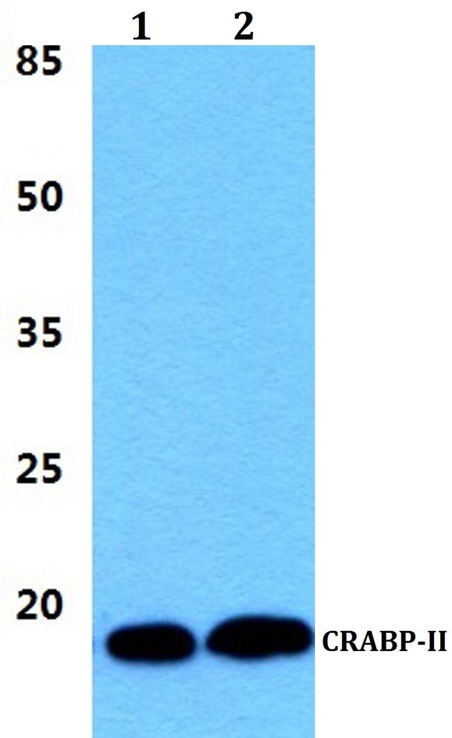 CRABP2 Antibody in Western Blot (WB)