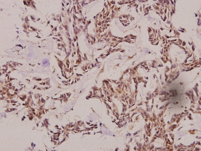 Cathepsin E Antibody in Immunohistochemistry (Paraffin) (IHC (P))