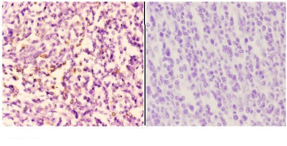 PIK3CA Antibody in Immunohistochemistry (Paraffin) (IHC (P))