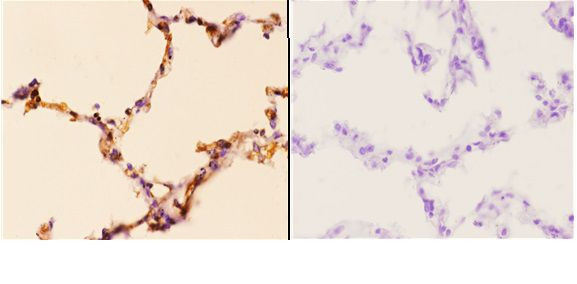 PIK3CA Antibody in Immunohistochemistry (Paraffin) (IHC (P))