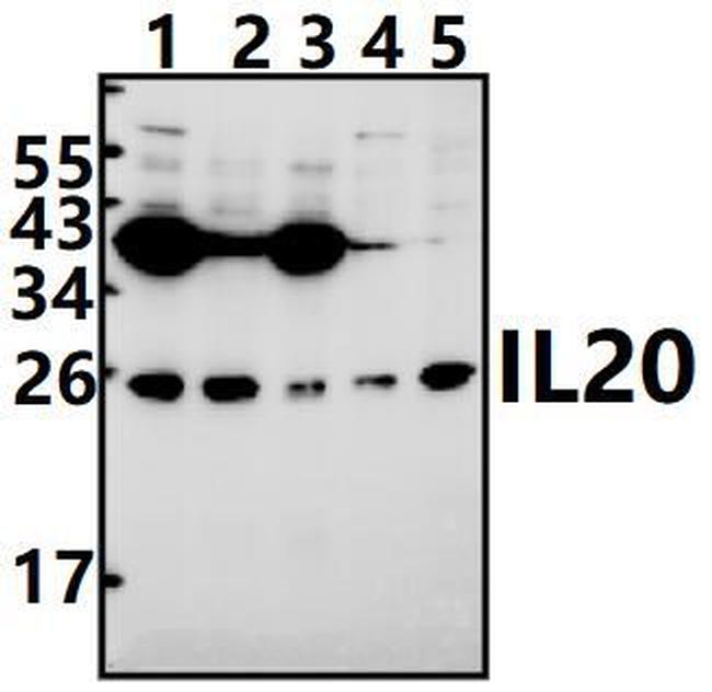 IL-20 Antibody in Western Blot (WB)