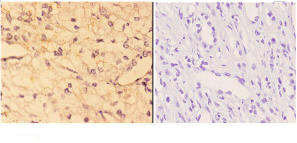 ACE Antibody in Immunohistochemistry (Paraffin) (IHC (P))