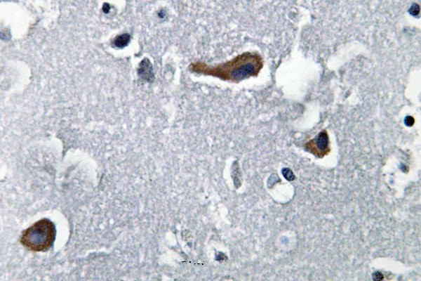 MAP2 Antibody in Immunohistochemistry (Paraffin) (IHC (P))