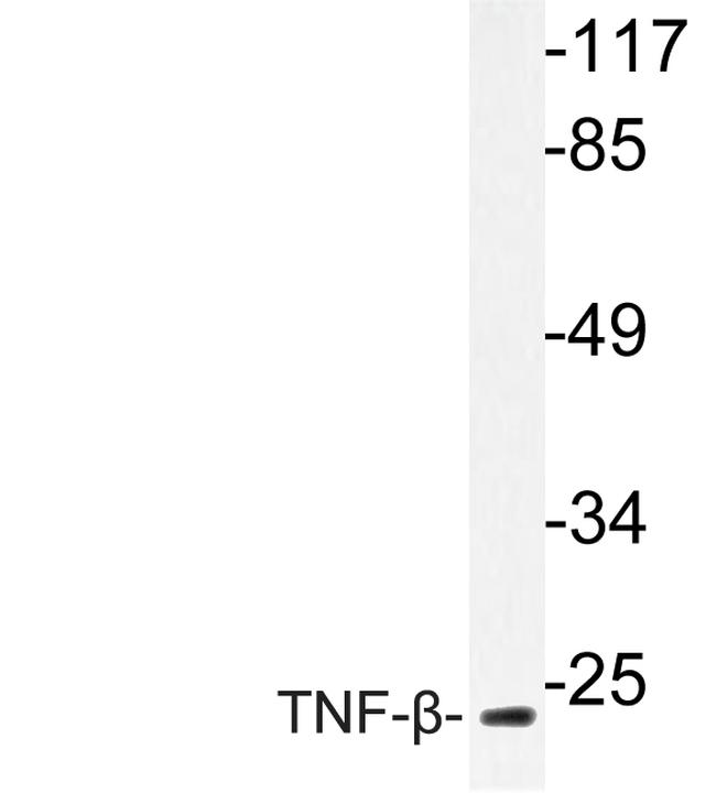 TNF beta Antibody in Western Blot (WB)