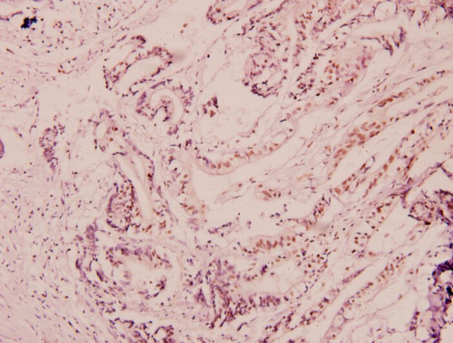 NF-H Antibody in Immunohistochemistry (Paraffin) (IHC (P))