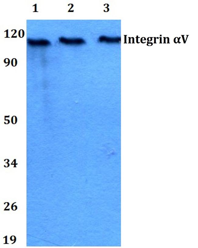 CD51 Antibody in Western Blot (WB)