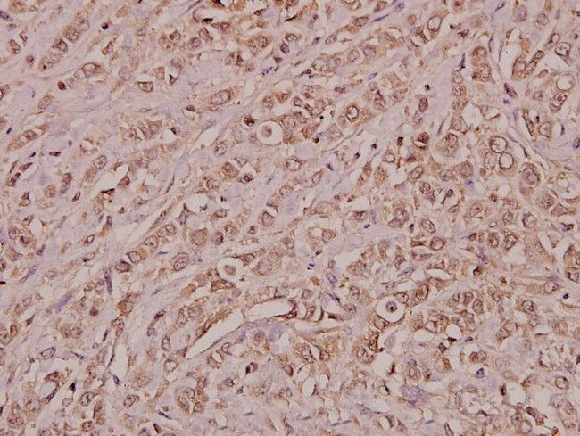 Annexin A3 Antibody in Immunohistochemistry (Paraffin) (IHC (P))