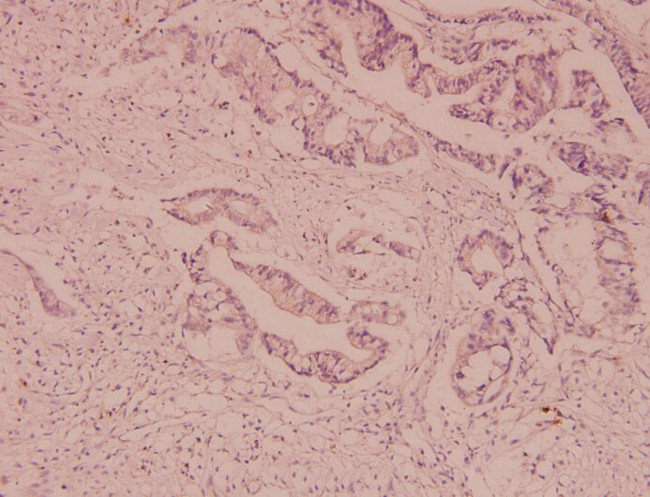 P-Glycoprotein Antibody in Immunohistochemistry (Paraffin) (IHC (P))