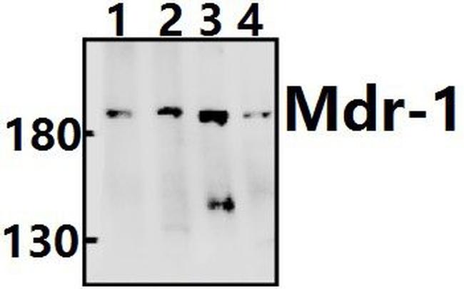 P-Glycoprotein Antibody in Western Blot (WB)