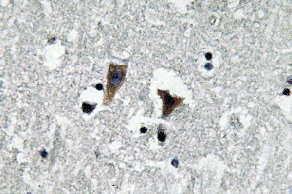 MAOA Antibody in Immunohistochemistry (Paraffin) (IHC (P))