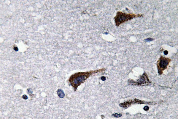 Cathepsin B Antibody in Immunohistochemistry (Paraffin) (IHC (P))